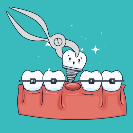 Orthodontics Gini Dental Home
